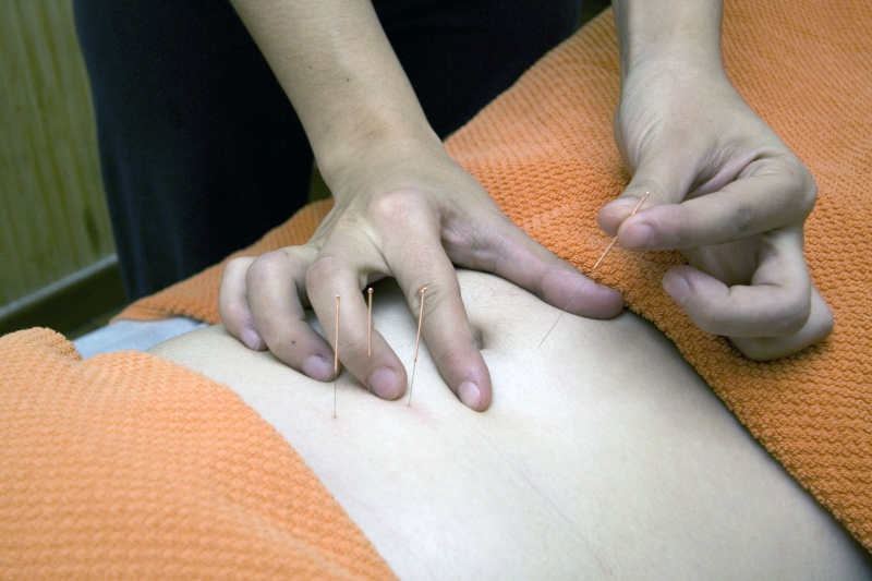 osteopathe-TOUET DE L ESCARENE-min_acupuncture-4175625